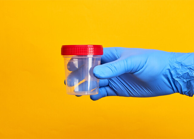 30/09 - OFFERTA ANALISI DELLE URINE - SETTEMBRE
